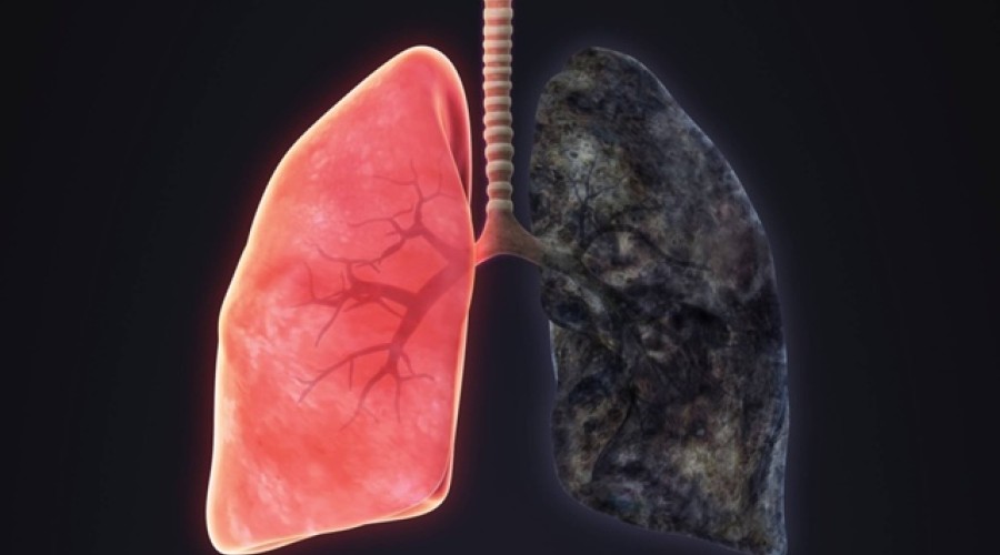 Учёные: лёгкие курильщика могут восстановиться после отказа от сигарет